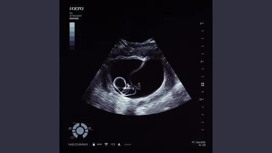 Kappa Lyrics English Translation — En Attendant Paphos | Nahir | Vacra