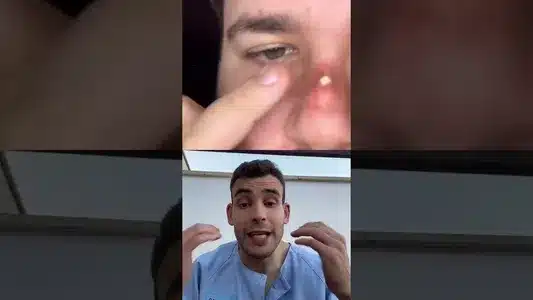 Entre Locos Lyrics Meaning — Dandoles Clase | Clase Personal